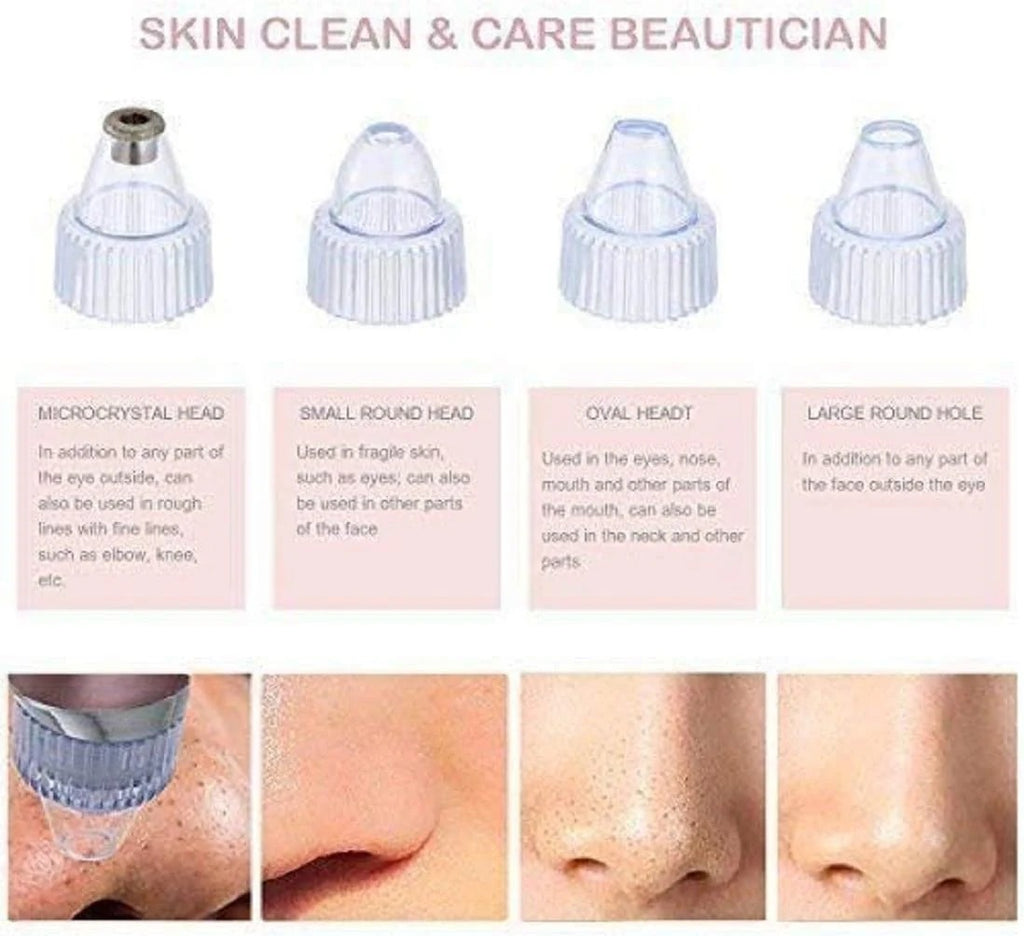 Electric Blackhead Remover Pore Vacuum – USB Rechargeable Facial Pore Cleaner with 5 Suction Levels & 4 Probes
