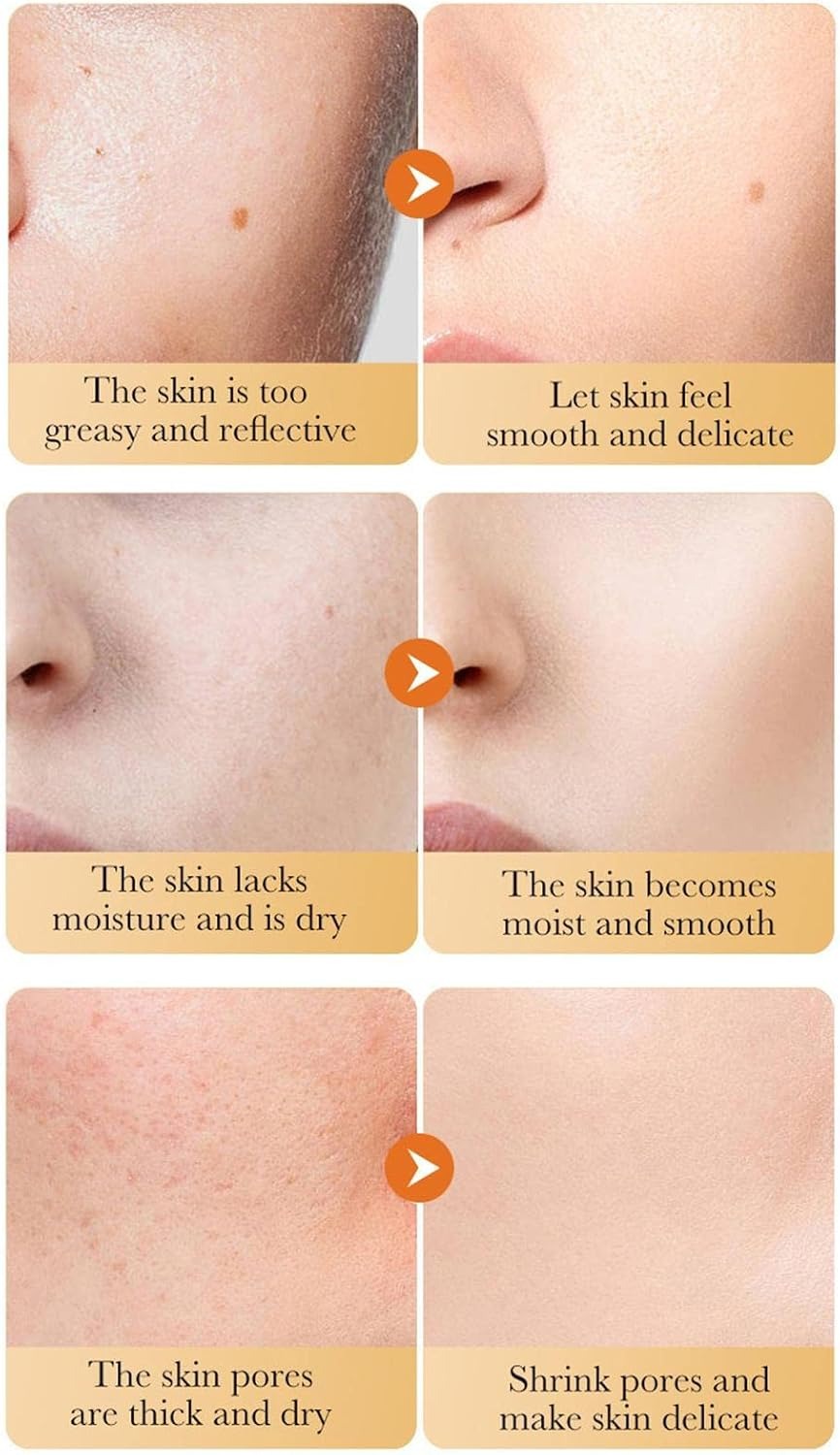 SADOER Turmeric Face Cream 50g – Anti-Acne, Deep Moisturizing & Brightening Face Cream with Fermented Curcumin