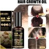South Moon Ginger Hair Growth Oil 50ml – Hair Loss Treatment & Natural Hair Regrowth Serum