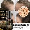 South Moon Ginger Hair Growth Oil 50ml – Hair Loss Treatment & Natural Hair Regrowth Serum